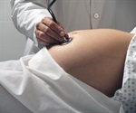 CD11c Microglia Play Key Role in Neurodevelopmental Delays from Maternal Inflammation