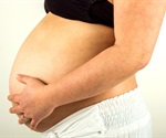 CD11c Microglia Play Key Role in Neurodevelopmental Delays from Maternal Inflammation