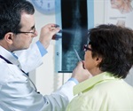 Study shows two phases of wall restructuring after an aneurysm forms