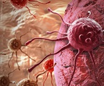 Nutrient Tug-of-War Between Tumor and Immune Cells Could Be Targeted for Cancer Therapy