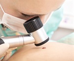 Mutation Profiling Reveals Therapeutic Targets in Lung Squamous Cell Carcinoma