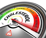 Novel Fluorescent Probes Illuminate Cholesterol Dynamics in Live Cells