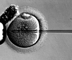 AI-Powered Protein Engineering for Precise and Scalable Gene Therapy