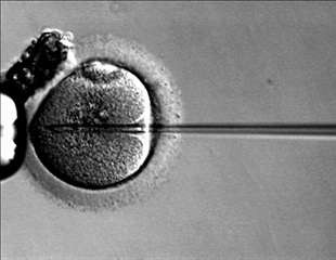 Virally Mediated Gene Therapy Rescues Hearing in Aging Mice