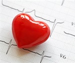 The immune system can play a key role in improving recovery from heart attacks