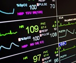 Mount Sinai researchers reveal mechanisms underlying autoimmunity in Down syndrome