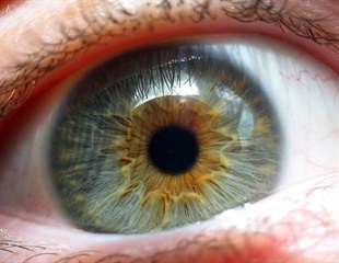 Breakthrough in Treating Age-Related Macular Degeneration with Retinal Stem Cells