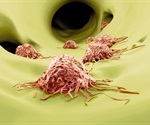 Evolution of Cancer Genomes During Metastasis