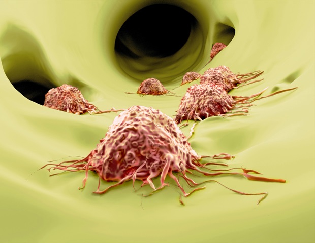 Cancers Use Lipids Produced by Lung Cells to Support Metastatic Tumor Growth