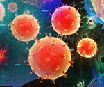 Broad Spectrum Pathogen Detection Achieved Through Metagenomic Sequencing