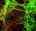 Genetic Signatures of Neural Progenitor Cells Uncovered in the Adult Brain