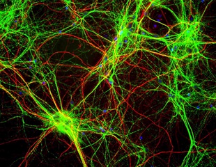 Genetic Signatures of Neural Progenitor Cells Uncovered in the Adult Brain