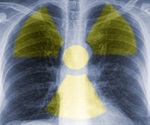 Pre-Targeted Radioimmunotherapy System Cures Fatal Ovarian Cancer in Preclinical Study