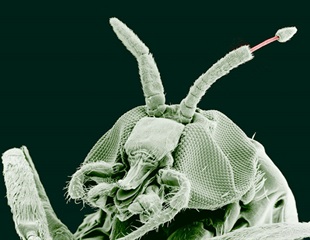 LSTM Research Identifies 91 RNA Viruses in Parasitic Worms