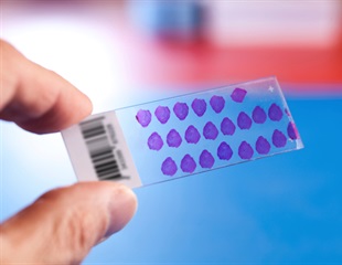 Presage Biosciences and AstraZeneca Partner to Advance Immuno-Oncology Research for Head and Neck Cancer