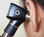 New Gene Therapy may be on the Horizon for Usher Syndrome Type 1F