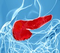 Scientists Discover Epigenetic Marks in Pancreatic Cancer Transition