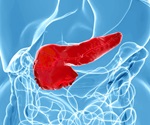 Novel Organoid Model Sheds Light on Human Pancreas Development and Disease