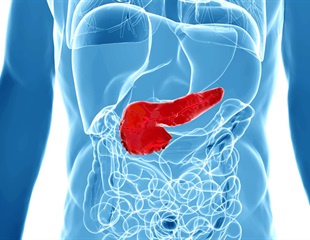 Researchers Discover That Lesion Cells Fail to Recruit Surrounding Tissue Into Tumor Growth Helpers
