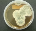 Researchers Capture Real-Time Molecular Movie of Penicillin Enzymatic Ring Closure