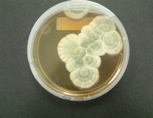 Researchers Capture Real-Time Molecular Movie of Penicillin Enzymatic Ring Closure