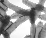 Fomepizole may reduce disease severity in the lungs of mice with bacterial pneumonia