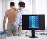 Less addictive opioid may have the ability to slow progression of osteoarthritis