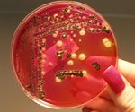Few Chicken Products with Highly Virulent Salmonella Strains Responsible for Most Illnesses