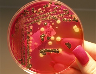 New Insights Into Salmonella’s Ability to Manipulate the Gut Microbiota