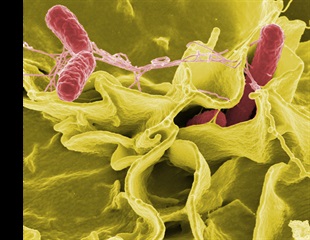 Whole Genome Sequencing Reveals New Insights into Providencia rustigianii
