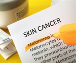 Innovative Genomic Technology Uncovers Mechanisms of Marjolin's Ulcer