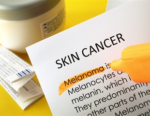 Unmasking the Molecular Mechanisms of Melanoma