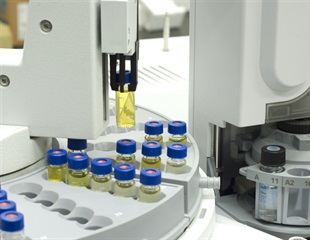 Imaging mass spectrometry identifies tumor markers for head and neck squamous cell carcinoma