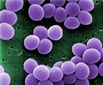 Mapping Bacterial Responses to Reactive Nitrogen and Oxygen Species