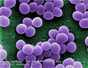 UC San Diego and UC Berkeley Collaborate on Innovative Antibiotic Resistance Solution