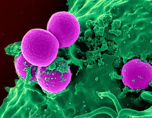 ‘Superbug’ Found to Digest Medical Plastic