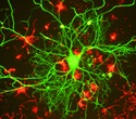 Study Identifies New Biological Pathways for Neurodegenerative Treatments