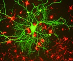 New method triggers and analyzes the dynamics of brain protein linked to Alzheimer’s