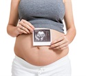 Placental Microenvironment Reprograms Innate Immune Cells to Prevent Inflammation