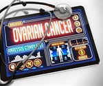 High-throughput screening identifies potential drugs for low-grade serous ovarian cancer