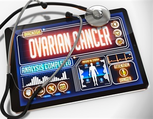High-throughput screening identifies potential drugs for low-grade serous ovarian cancer