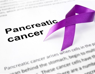 Key Factor in Pancreatic Cancer Cell Survival in Distinct Environments