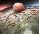 New technique identifies tumor-associated microbes