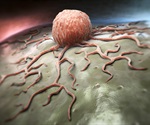 New Insights Into Tumor-Immune Interactions Could Lead to More Effective Therapies for Multiple Myeloma