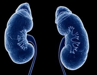 Genetic Analysis Unveils Underlying Causes of Chronic Kidney Disease