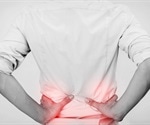 Genes may be Responsible for Third of Complex Regional Pain Syndrome Cases