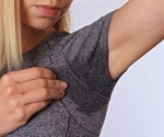 Engineered Mice Carrying the Genetic Variant Develop Excessive Sweating