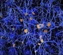 Boosting metabolic resources in the brain could be a way to slow neurodegeneration