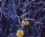 Novel Approach to Isolating and Quantifying EV Cargo for Disease Diagnosis