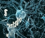 Largest proteomic study reveals link between glucose metabolism proteins and AD biology
